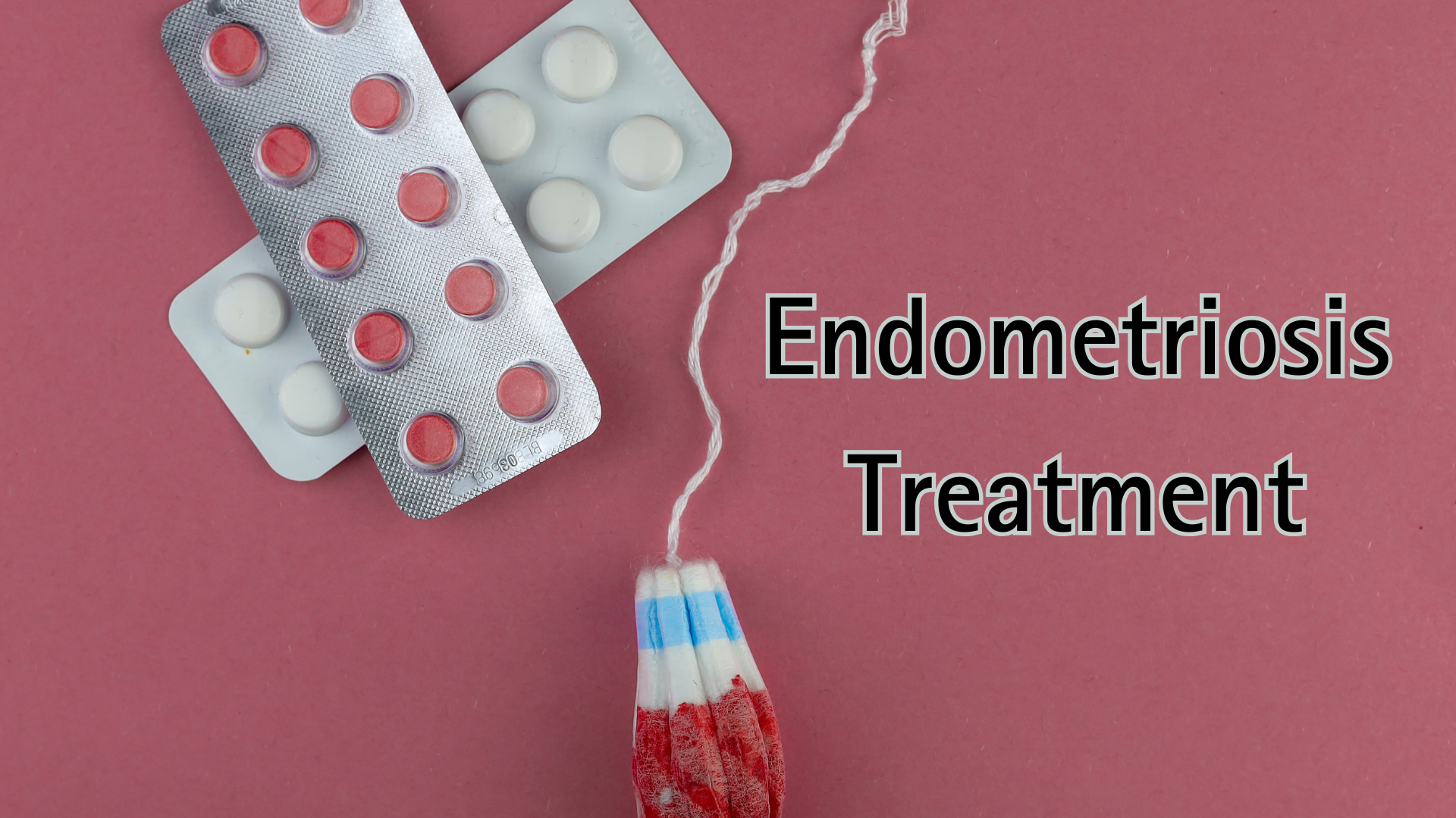 Endometriosis Treatment : A Journey to Better Health !