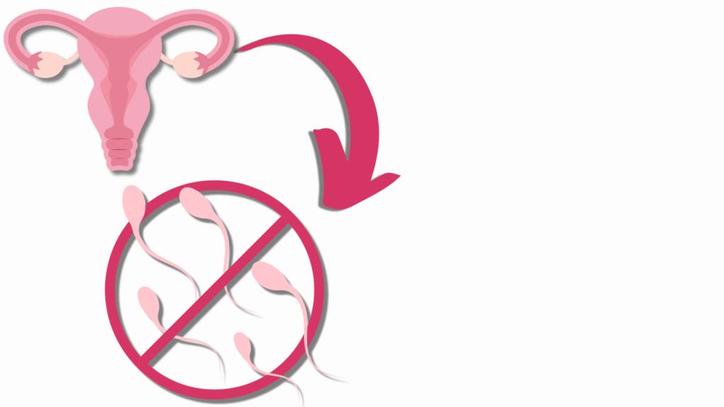 Does PCOS cause infertility?