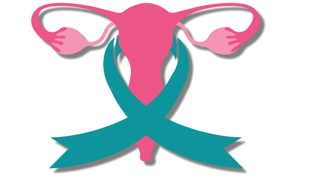 Ovarian Cancer Treatment: Awareness is a must !